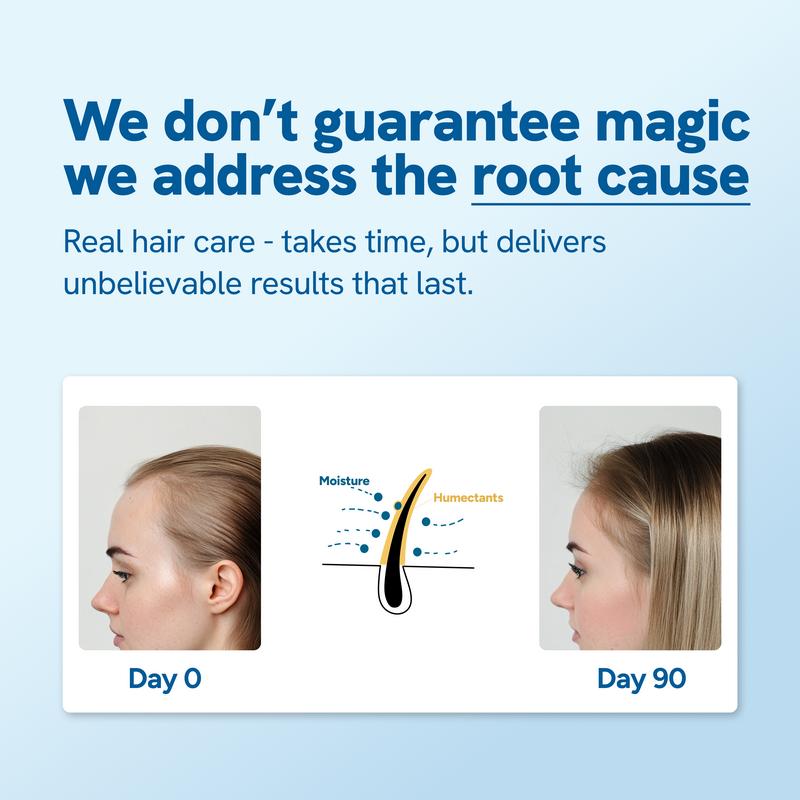 Bodywise Advanced Hair Growth Serum Roll On- For Hair Thinning, Herbal- (25ml)