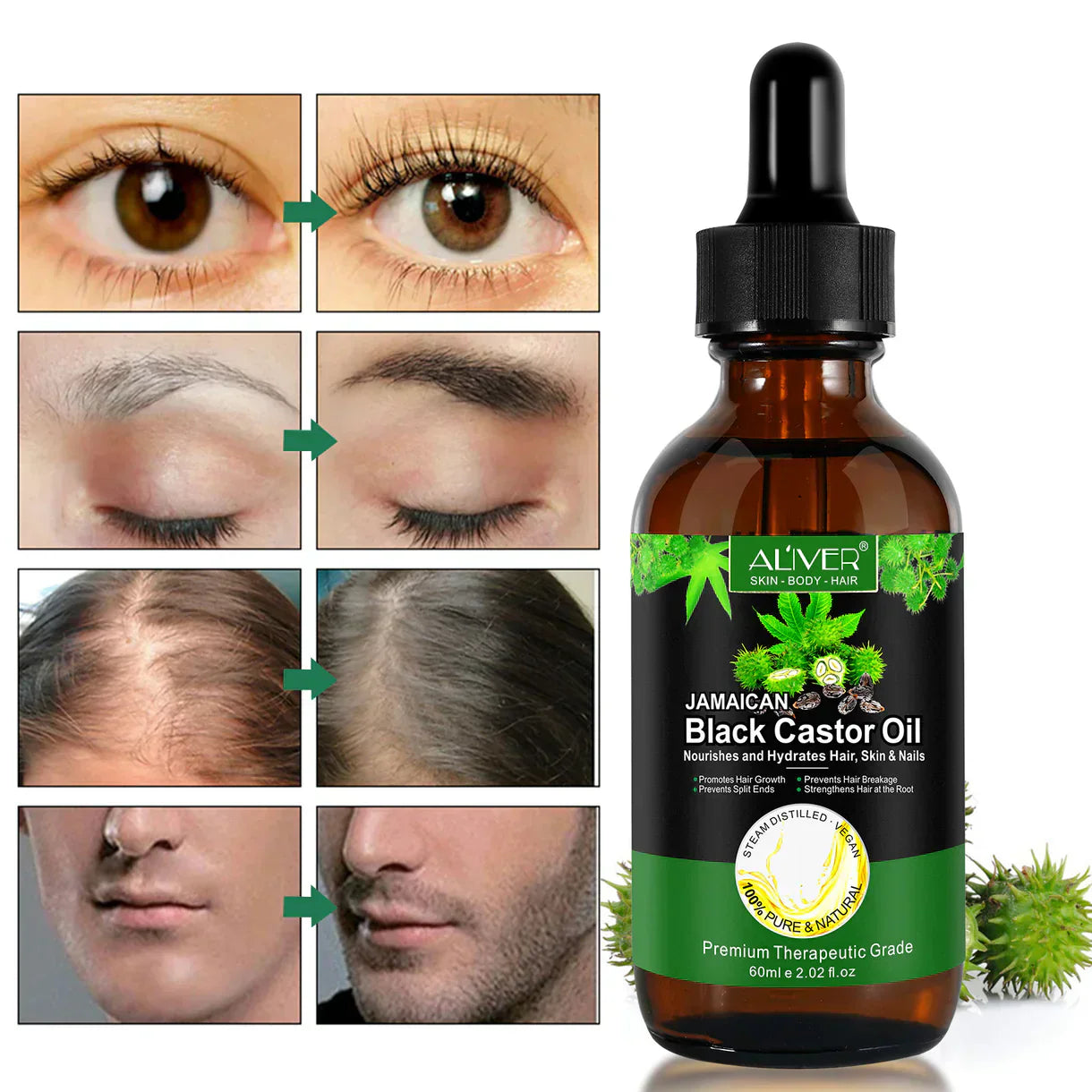 Aliver 100% Pure & Natural Jamaican Black Castor Oil Promotes hair growth，Prevent hair damage